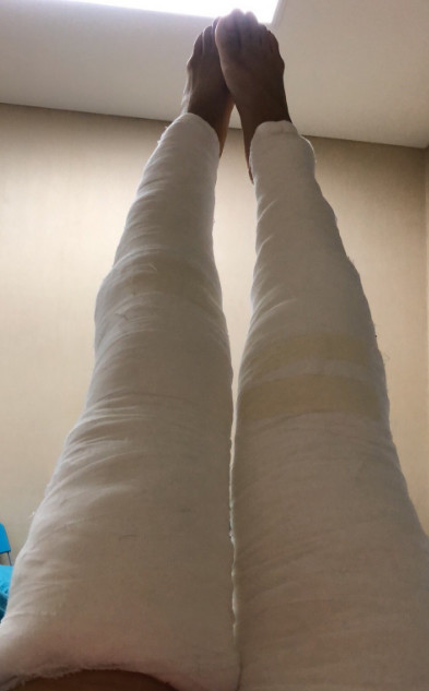 绑满绷带的双腿