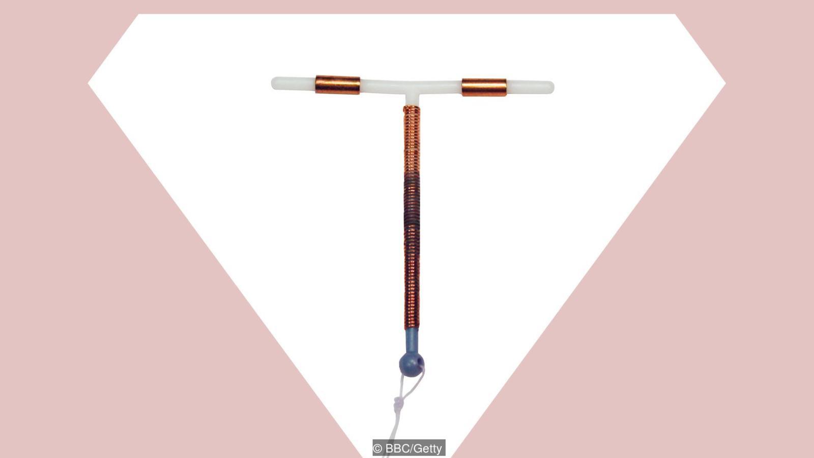 子宫内避孕器有效性99%,为啥使用的人却不多?