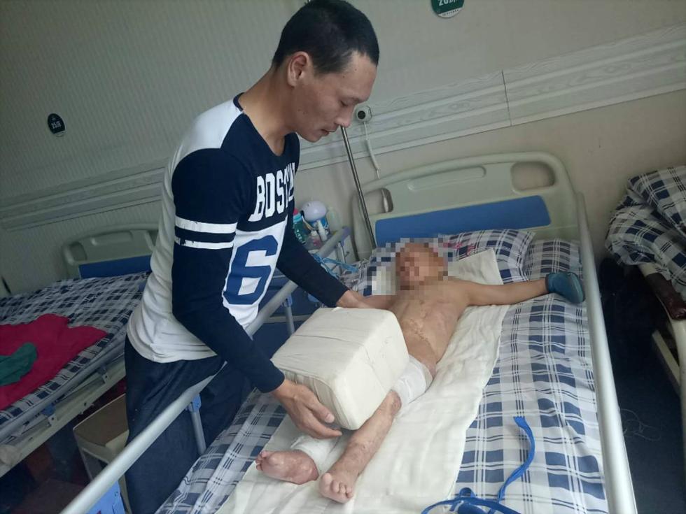 图为余静永小心地将用布包好的砖块压在儿子腿上.受访者供图