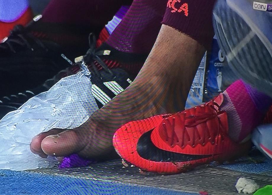 保利尼奥脚敷冰袋