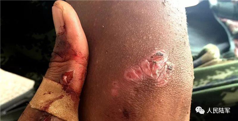 疼,看着就心疼!