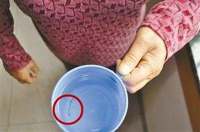 女子刷牙水龙头里流出恐怖东西 家人被这一幕惊呆