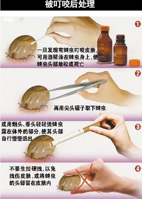 1家3人被蜱虫咬伤2人丧命 被咬后千万别生拉硬拽